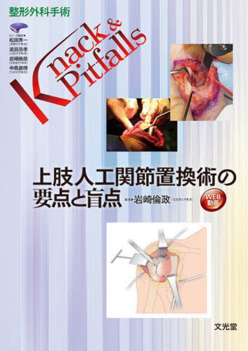 [書籍]/上肢人工関節置換術の要点と盲点 (整形外科手術Knack&Pitfalls)/岩崎倫政/編集/NEOBK-2741908 9,900円