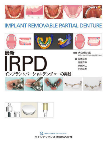 [書籍]/最新IRPDインプラントパーシャルデンチャーの実践/大久保力廣/編著 鈴木恭典/著 佐藤洋平/著 新保秀仁/著 白井麻衣/著/NEOBK-2798687