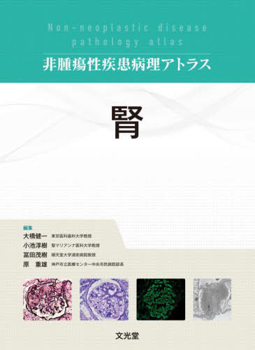 [書籍]/腎 (非腫瘍性疾患病理アトラス)/大橋健一/編集 小池淳樹/編集 冨田茂樹/編集 原重雄/編集/NEOBK-2799856