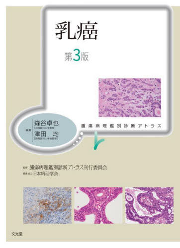 [書籍]/乳癌 第3版 (腫瘍病理鑑別診断アトラス)/森谷卓也/編集 津田均/編集 腫瘍病理鑑別診断アトラス刊行委員会/監修/NEOBK-2802039