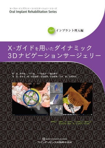 [書籍]/X-ガイドを用いたダイナミック3Dナビゲーションサージェリー (オーラル・インプラント・リハビリテーション・シリーズ)/鈴木仙一/監著 五十嵐一/監著 松成淳一/監著 脇田雅文/監著 森本太一朗/著 安倍稔隆/著 長尾龍典/著 中島航輝/著 今井遊/著 毛利国安/著/NEOBK-280