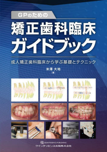[書籍]/GPのための矯正歯科臨床ガイドブック 成人矯正歯科臨床から学ぶ基礎とテクニック/米澤大地/著/NEOBK-2827406