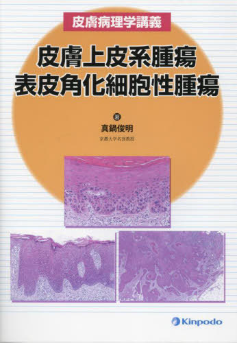 [書籍]/皮膚上皮系腫瘍 表皮角化細胞性腫瘍 皮膚病理学講義/真鍋俊明/著/NEOBK-2831605