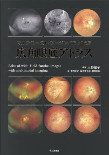 書籍]/精神科治療薬の考え方と使い方 「ストール精神薬理学