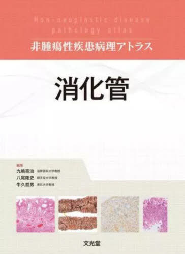 [書籍]/消化管 (非腫瘍性疾患病理アトラス)/九嶋亮治/編集 八尾隆史/編集 牛久哲男/編集/NEOBK-2850796