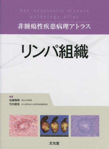 [書籍]/リンパ組織 (非腫瘍性疾患病理アトラス)/佐藤康晴/編集 竹内賢吾/編集/NEOBK-2853062