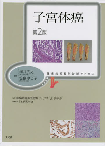 [書籍]/子宮体癌 (腫瘍病理鑑別診断アトラス)/柳井広之/編集 笹島ゆう子/編集 腫瘍病理鑑別診断アトラス刊行委員会/監修/NEOBK-2853069