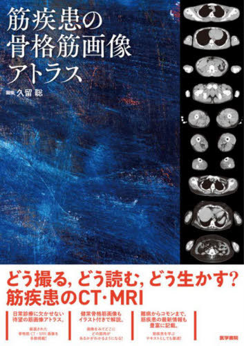 [書籍]/筋疾患の骨格筋画像アトラス/久留聡/編集 久留聡/〔ほか〕執筆/NEOBK-2855778
