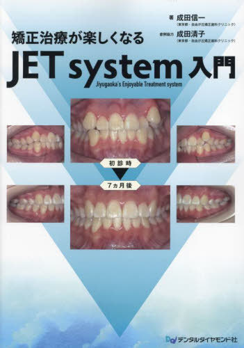 [書籍]/矯正治療が楽しくなるJETsystem入/成田信一/著 成田清子/症例協力/NEOBK-2872402