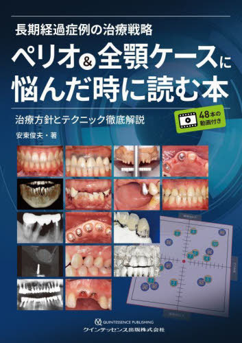 [書籍]/長期経過症例の治療戦略ペリオ&amp;全顎ケースに悩んだ時に読む本 治療方針とテクニック徹底解説/安東俊夫/著/NEOBK-2876975