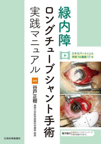 [書籍]/緑内障ロングチューブシャント手術実践マニュアル/谷戸正樹/編著/NEOBK-2894837
