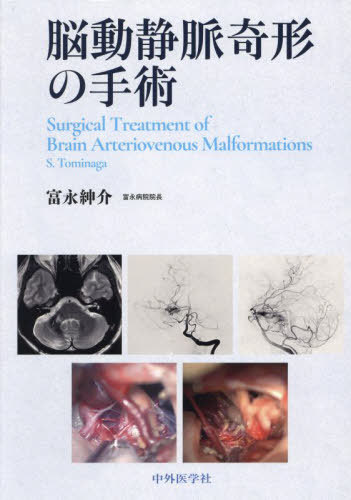 [書籍]/脳動静脈奇形の手術/富永紳介/著/NEOBK-2898702