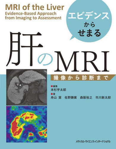[書籍]/エビデンスからせまる 肝のMRI/本杉宇太郎/編集 舟山慧/著 佐野勝廣/著 森阪裕之/著 市川新太郎/著/NEOBK-2918189