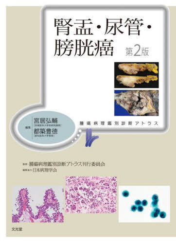 [書籍]/腎盂・尿管・膀胱癌 (腫瘍病理鑑別診断アトラス)/宮居弘輔/編集 都築豊徳/編集 腫瘍病理鑑別診断アトラス刊行委員会/監修/NEOBK-2921475