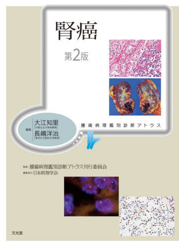 [書籍]/腎癌 (腫瘍病理鑑別診断アトラス)/大江知里/編集 長嶋洋治/編集 腫瘍病理鑑別診断アトラス刊行委員会/監修/NEOBK-2921478