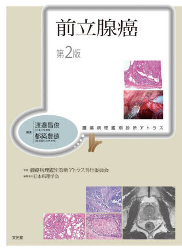 [書籍]/前立腺癌 (腫瘍病理鑑別診断アトラス)/渡邉昌俊/編集 都築豊徳/編集 腫瘍病理鑑別診断アトラス刊行委員会/監修/NEOBK-2932694