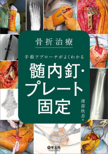 深在性う蝕に対するVital Pulp Therapy 歯髄保存か抜髄かは患者のため