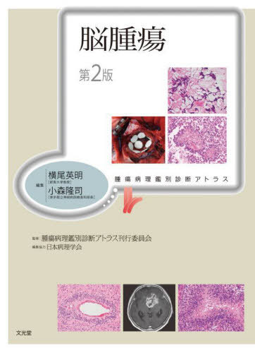 [書籍]/脳腫瘍 (腫瘍病理鑑別診断アトラス)/横尾英明/編集 小森隆司/編集 腫瘍病理鑑別診断アトラス刊行委員会/監修/NEOBK-2955361