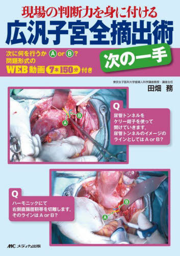 [書籍]/広汎子宮全摘出術次の一手 現場の判断力を身に付ける/田畑務/著/NEOBK-2971780