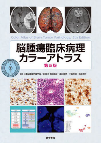 [書籍]/脳腫瘍臨床病理カラーアトラス/日本脳腫瘍病理学会/編集/NEOBK-2982297