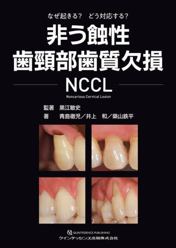 [書籍]/非う蝕性歯頸部歯質欠損NCCL なぜ起きる?どう対応する?/黒江敏史/監著 青島徹児/著 井上和/著 築山鉄平/著/NEOBK-3014393