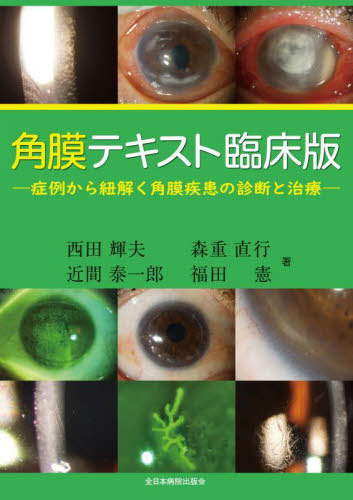 [書籍]/角膜テキスト臨床版 症例から紐解く角膜疾患の診断と治療/西田輝夫/〔ほか〕著/NEOBK-3017778