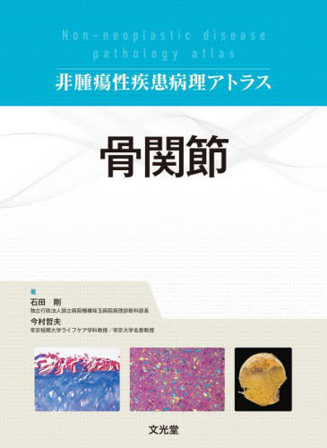 [書籍]/骨関節 (非腫瘍性疾患病理アトラス)/石田剛/著 今村哲夫/著/NEOBK-3033949