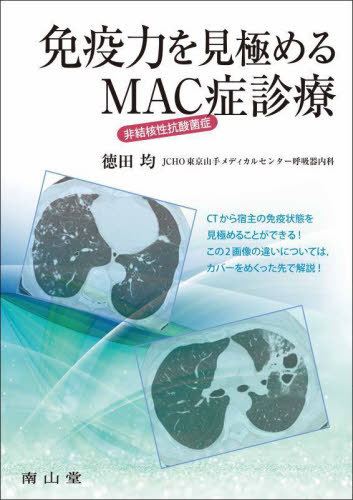 [書籍]/免疫力を見極めるMAC症診療/徳田均/著/NEOBK-3062048