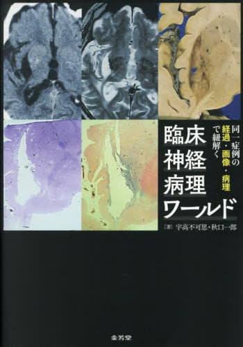 [書籍]/同一症例の経過・画像・病理で紐解く臨床神経病理ワールド/宇高不可思/著 秋口一郎/著/NEOBK-3081776