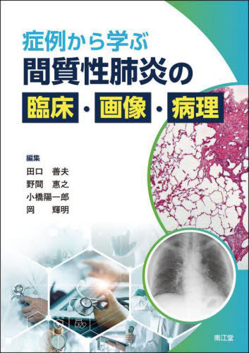 [書籍]/症例から学ぶ間質性肺炎の臨床・画像・病理/田口善夫/〔ほか〕編集/NEOBK-3088374