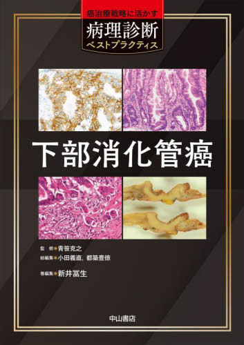 [書籍]/下部消化管癌 (癌治療戦略に活かす病理診断ベストプラクティス)/新井冨生/巻編集/NEOBK-3089947