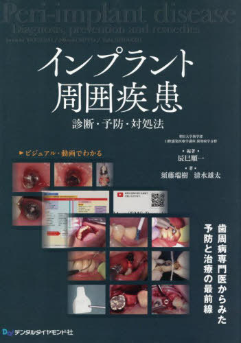書籍]/インプラント周囲疾患/辰巳順一須藤瑞樹/NEOBK-3103436の通販は