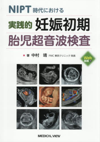 [書籍]/実践的妊娠初期胎児超音波検査 NIPT時代における/中村靖/著/NEOBK-3115733