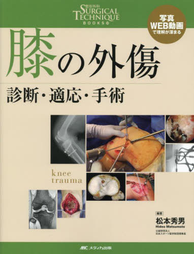 書籍]/膝の外傷 診断・適応・手術 写真・WEB動画で理解が深まる (整形