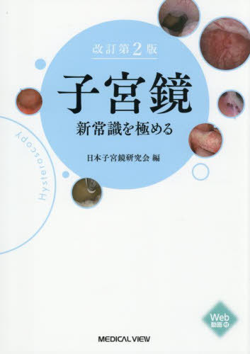 [書籍]/子宮鏡新常識を極める/日本子宮鏡研究会/編/NEOBK-3140490