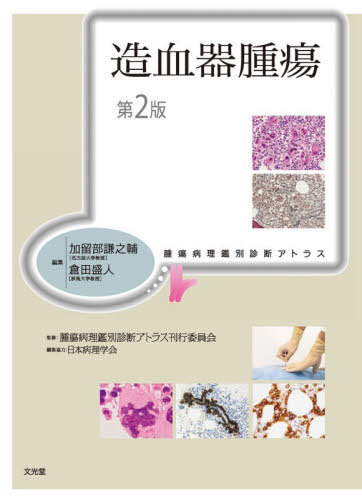 [書籍]/造血器腫瘍 (腫瘍病理鑑別診断アトラス)/加留部謙之輔/編集 倉田盛人/編集 腫瘍病理鑑別診断アトラス刊行委員会/監修/NEOBK-3191600