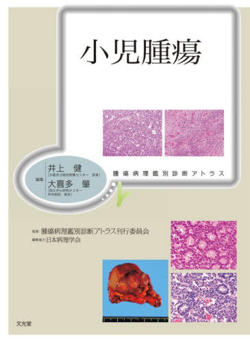 [書籍]/小児腫瘍 (腫瘍病理鑑別診断アトラス)/井上健大喜多肇/NEOBK-3193653