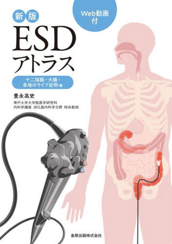 [書籍]/ESDアトラス 十二指腸・大腸・各地のライブ症例編/豊永高史/著/NEOBK-3208778