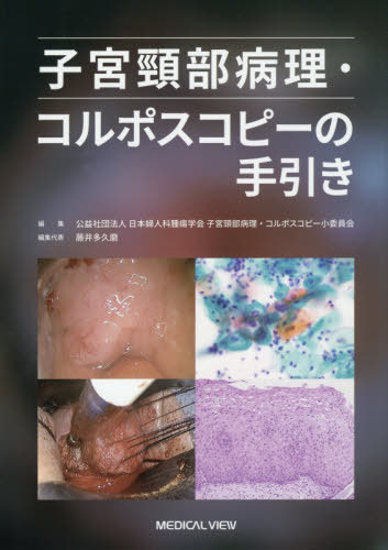 [書籍]/子宮頸部病理・コルポスコピーの手引き/日本婦人科腫瘍学会子宮頸部病理・コルポスコピー小委員会/編集 藤井多久磨/編集代表/NEOBK-3211667