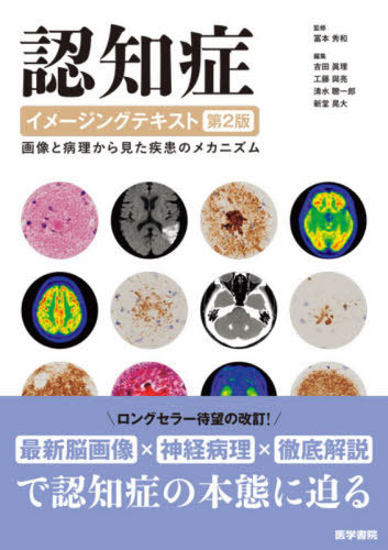 [書籍]/認知症イメージングテキスト 画像と病理から見た疾患のメカニズム/冨本秀和/監修 吉田眞理/〔ほか〕編集/NEOBK-3213613