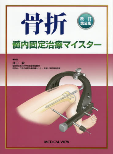 [書籍]/骨折髄内固定治療マイスター/澤口毅/編集/NEOBK-3214684