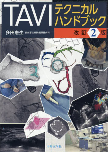 [書籍]/TAVIテクニカルハンドブック/多田憲生/著/NEOBK-3246280