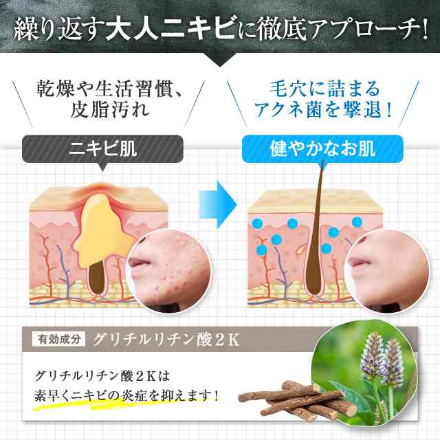 化粧水 にきび ニキビケア ACNE FORCE AQUA アクネケア 毛穴 大人 薬用にきび 肌荒れ 薬用 毛穴ケア 思春期 大人ニキビケア あご  毛穴 角の通販はau PAY マーケット - Ｂｏｄｙ Ｌｉｔｅ Ｃｈａｎｇｅ