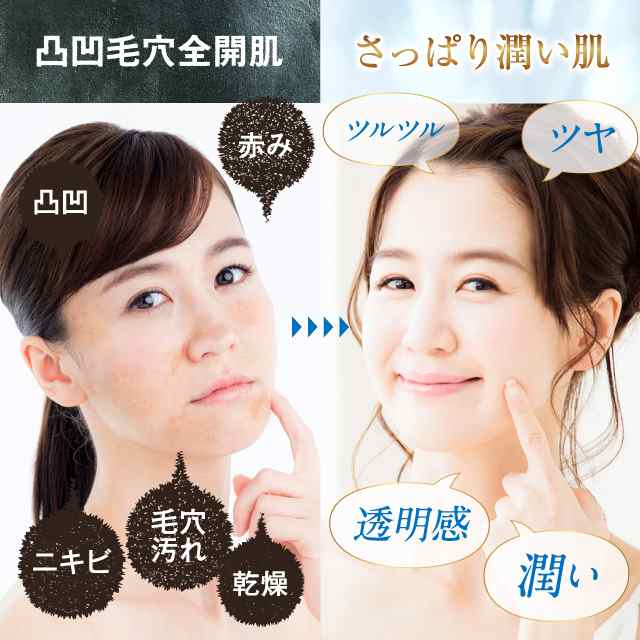 化粧水 にきび ニキビケア Acne Force Aqua アクネケア 毛穴 大人 ニキビ 用薬用 ニキビ ケア あご おでこ 鼻 ニキビ 対策 薬用ローショの通販はau Pay マーケット ｂｏｄｙ ｌｉｔｅ ｃｈａｎｇｅ