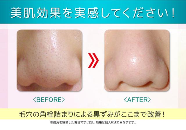 ウォーターピーリング 角質 皮脂ケア アクアピュアスキン 超音波 美顔器 スクライバー イオン導入 導出 スキンケア 光エステ 振動 美肌 の通販はau Pay マーケット Moise