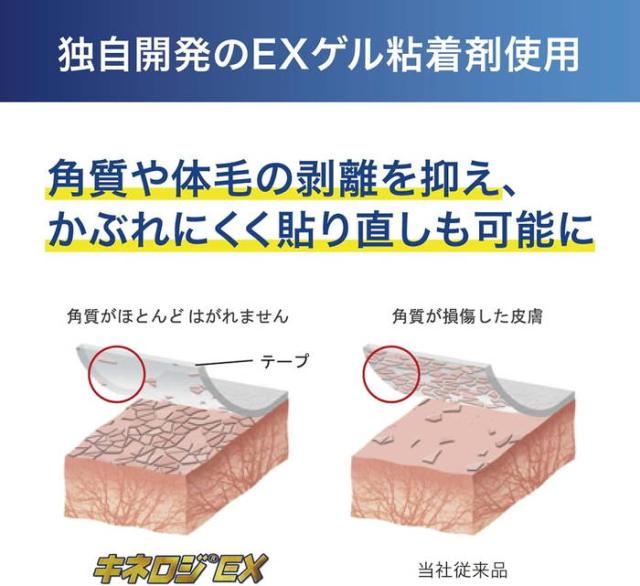 ニトリート メンズ レディース ジュニア キネロジEX 75mm×31.5m×1巻入 テーピング 筋肉 炎症 保護 運動 関節 スポーツ トレーニング かぶれにくい 送料無料 NITREAT NKEX-75L