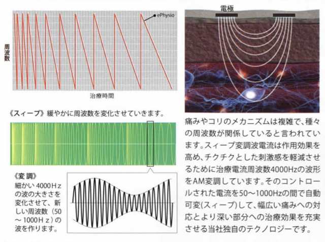 ひざケア ひざ専用 家庭用 ひざ治療器 SM1MT 低周波治療器 膝 痛み 医療機器認証 日本製 マルタカテクノ 送料無料の通販はau PAY  マーケット - BODYSOULショップ