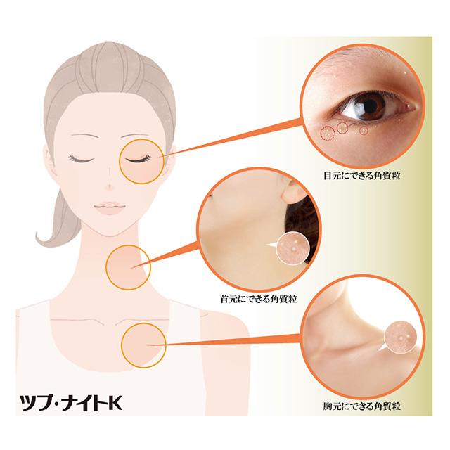 首のイボ 取り クリーム いぼ取り 目元 顔 首 角質 粒 ケア 口コミ ハトムギ ヨクイニン 杏仁 ハトムギ ツブ ナイトk ローションの通販はau Pay マーケット 美活応援店 アットシュシュ Au Pay マーケット店