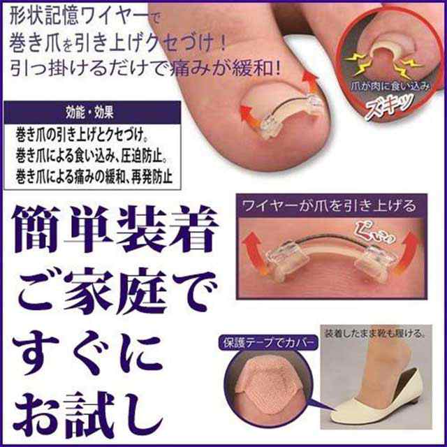 巻き爪ワイヤーガード 一般医療機器 巻き爪 治療 矯正 リフト クリップ 巻爪 ケア テープの通販はau PAY マーケット - 美活応援店  アットシュシュ au PAY マーケット店