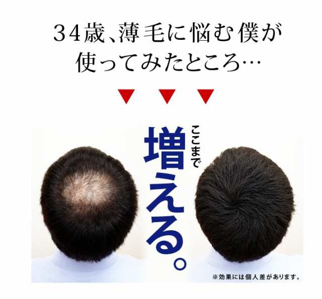 ヘアスプレー ヘアフォロー 増毛スプレー ボリュームアップ 白髪かくし 薄毛カバー 薄毛対策 メンズ レディースの通販はau Pay マーケット アイメディアwebshop